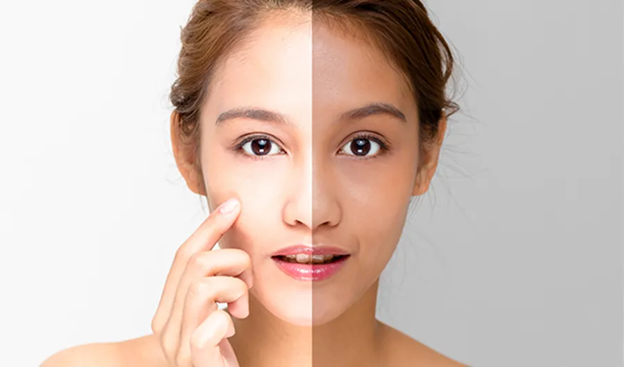25794 chemical peel treatment