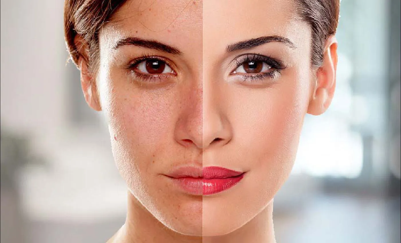 25794 even skin tone treatment