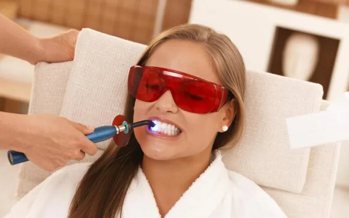 25796 teeth whitening uk overview