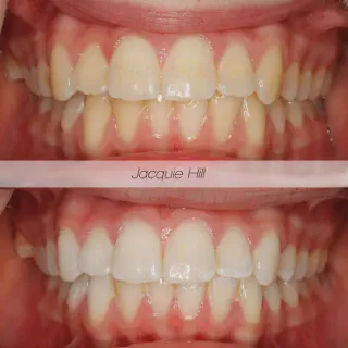 /img/25796-teeth-whitening-uk-smile.webp