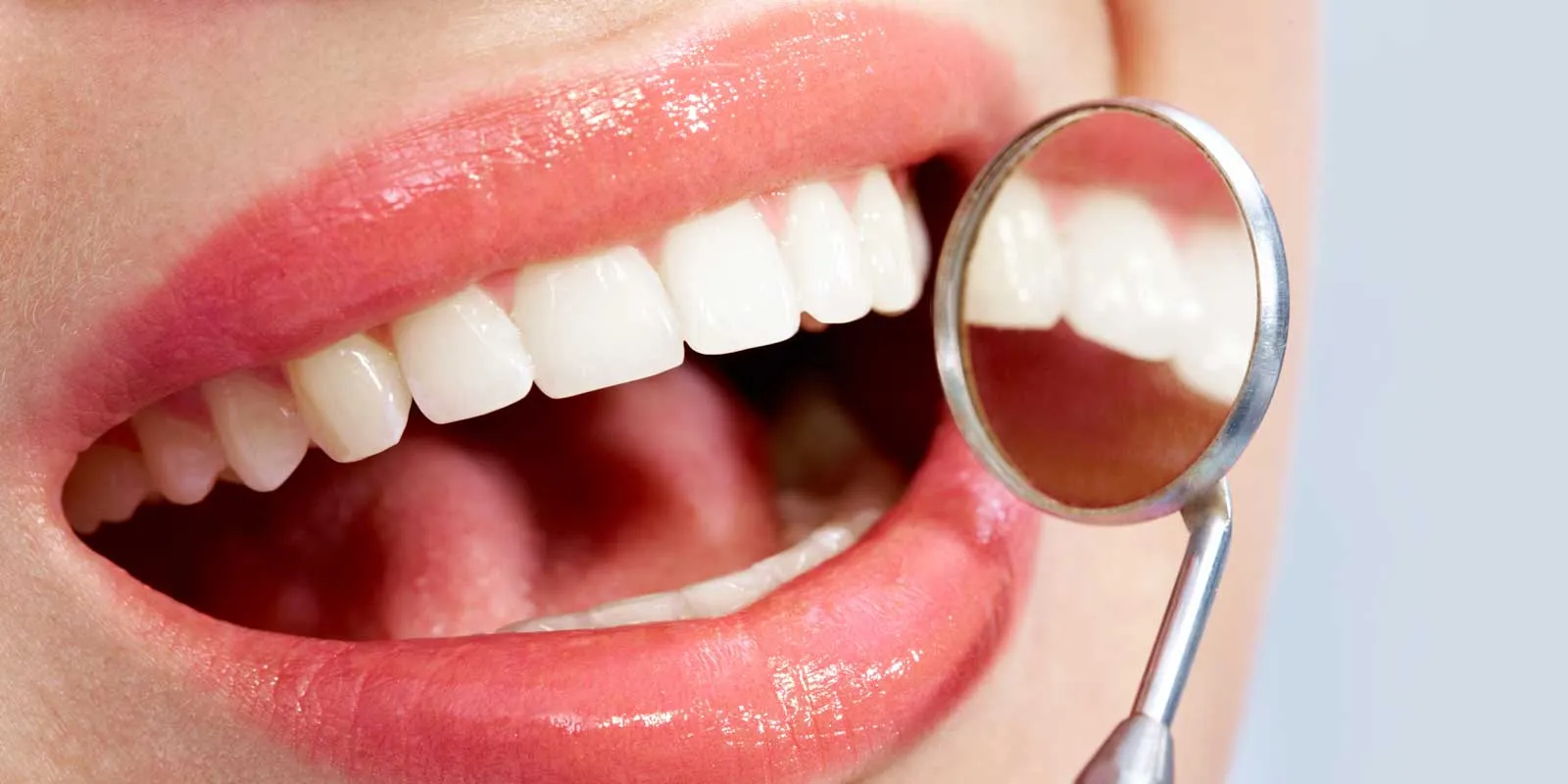 25800 at home teeth whitening