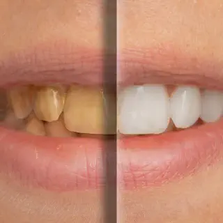 /img/25805-bright-smile.webp