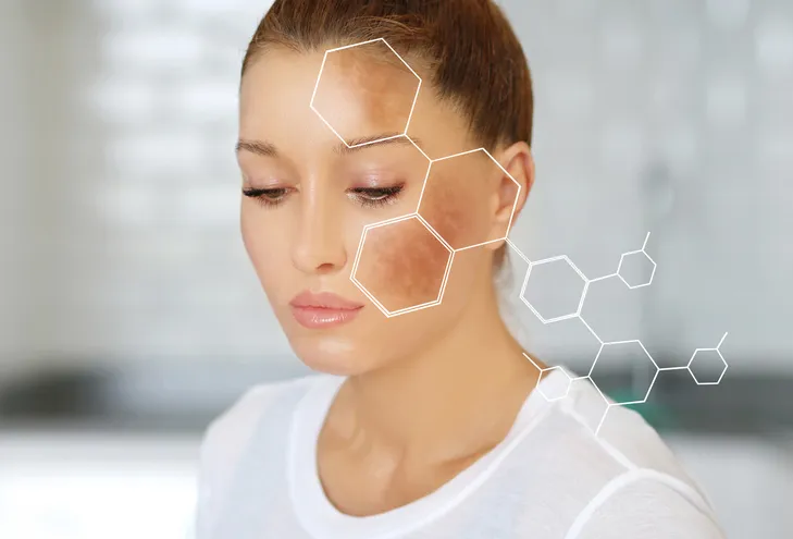 25807 laser whitening types