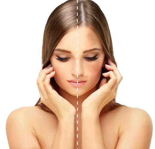 /img/25807-whitening-maintenance.webp