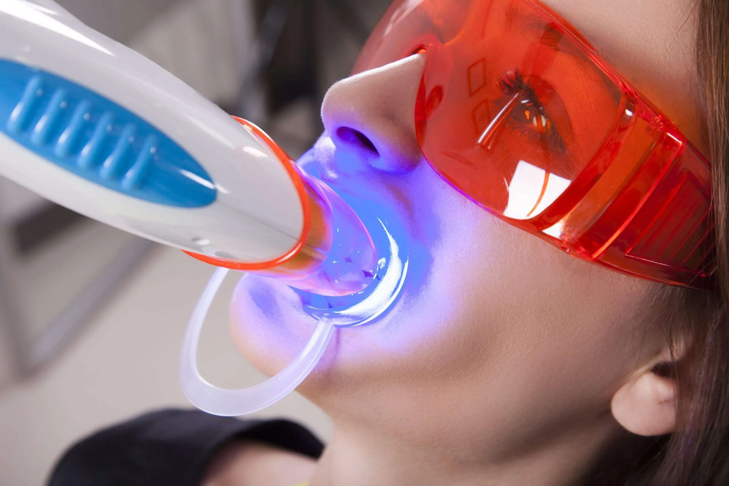 25814 teeth whitening comparison
