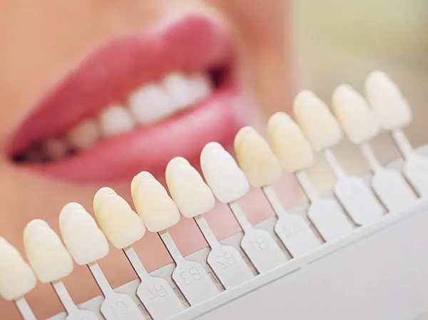 25818 teeth whitening sensitive teeth