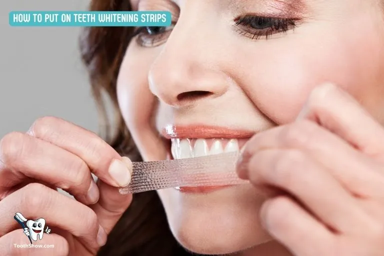 25821 teeth whitening strip placement