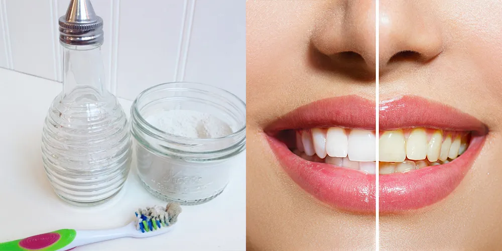 25822 strawberry teeth whitening