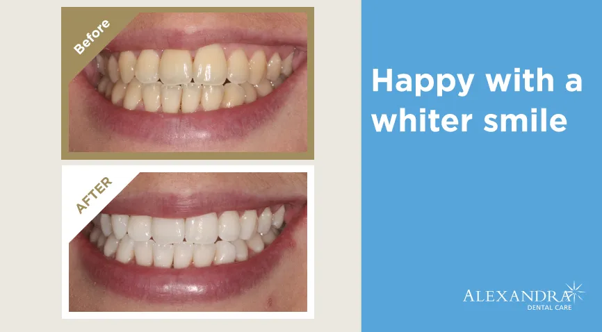 /img/25824-healthy-smile.webp