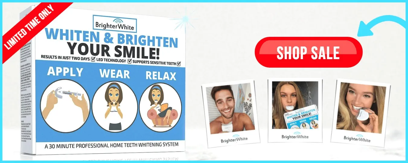 25824 teeth whitening before after