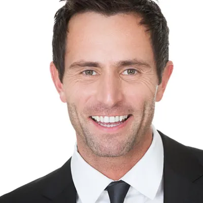25825 teeth whitening san jose before after