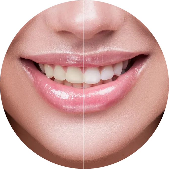25825 teeth whitening san jose dentist