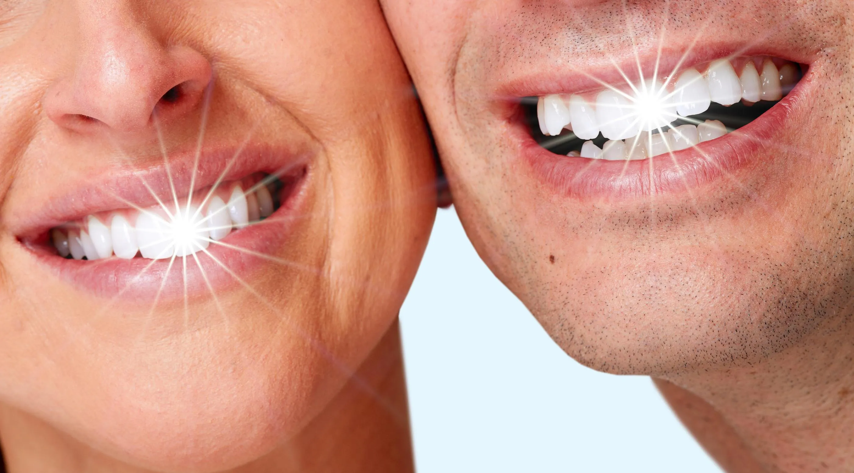 25825 teeth whitening san jose professional
