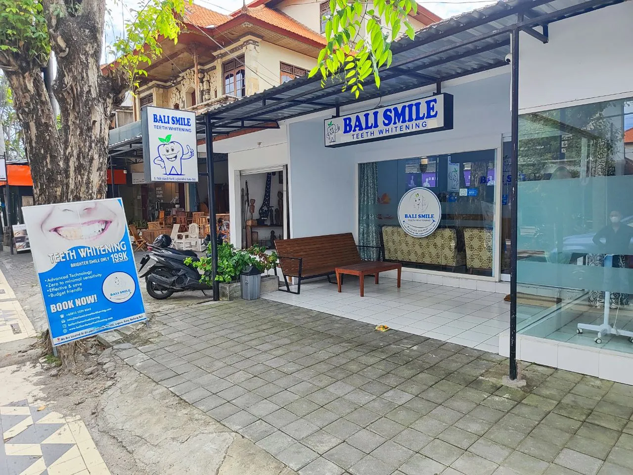 25831 teeth whitening bali results