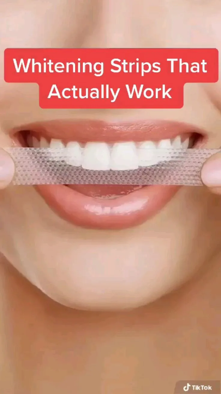 25836 teeth whitening failure 4
