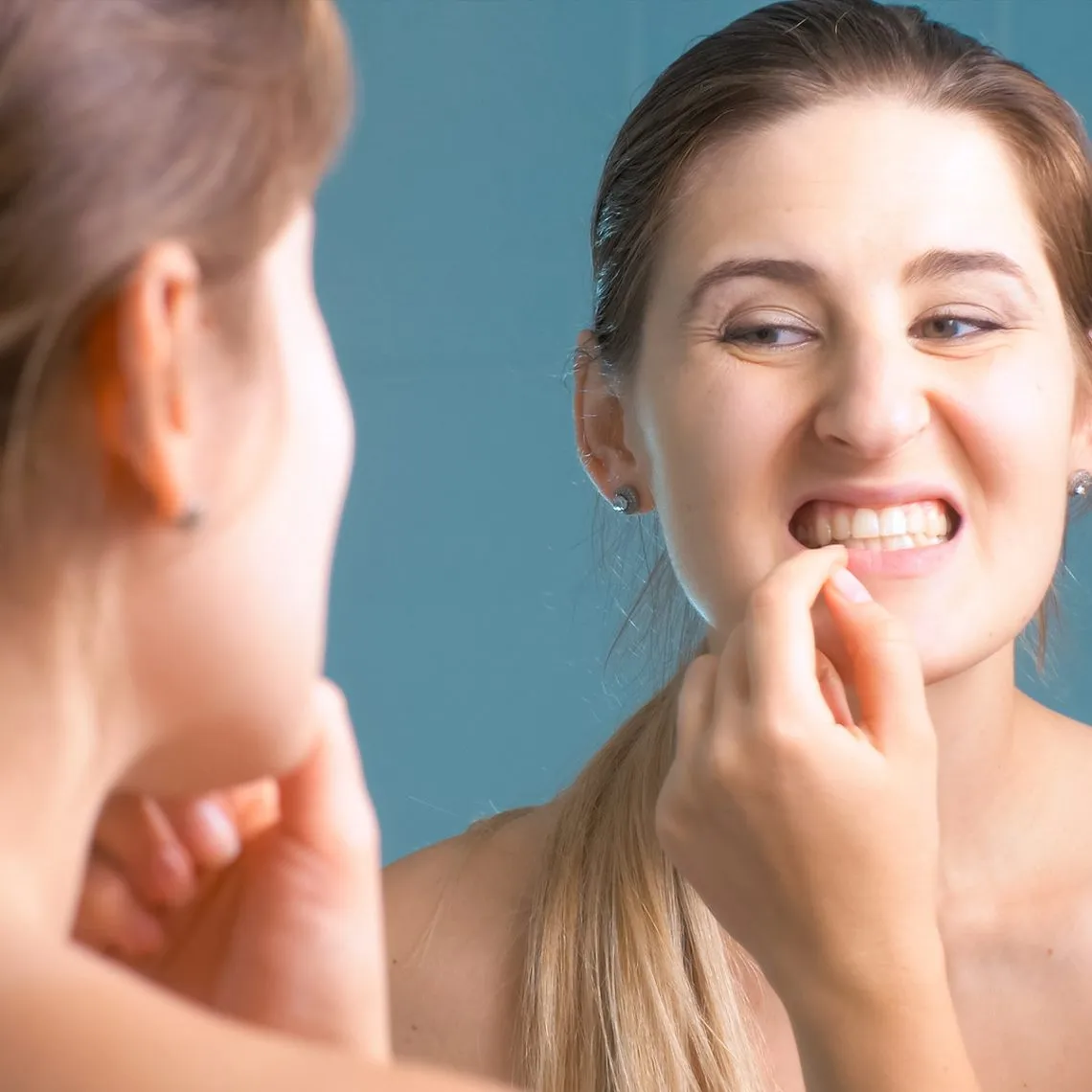 25836 teeth whitening failure 5