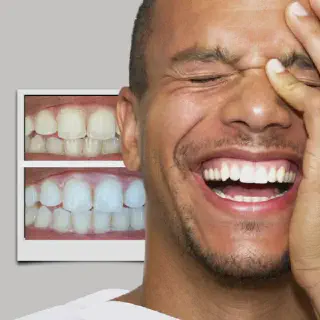 /img/25840-smiledirectclub-teeth-whitening-alternatives.webp