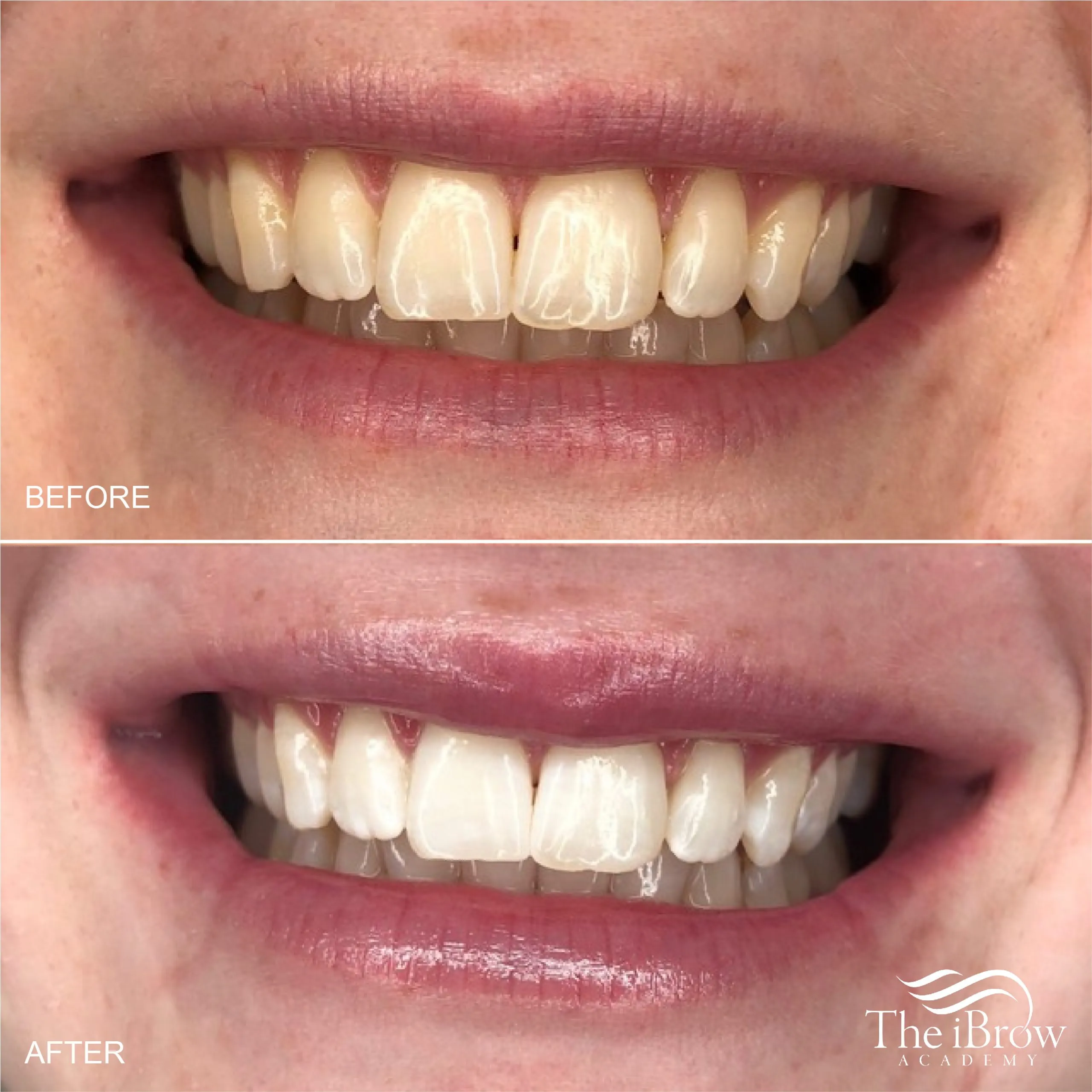 25843 mixing clay teeth whitening