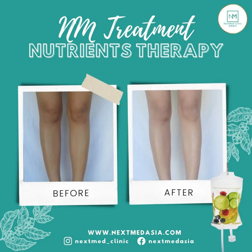 25844 whitening injection clinic 3