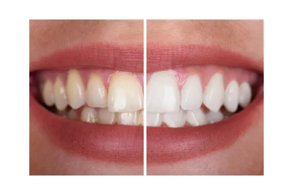 /img/25856-healthy-smile-waco-tx.webp
