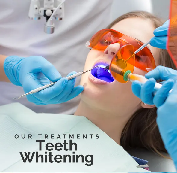 25863 teeth whitening northwest indiana 3