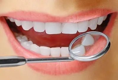 25871 teeth stains
