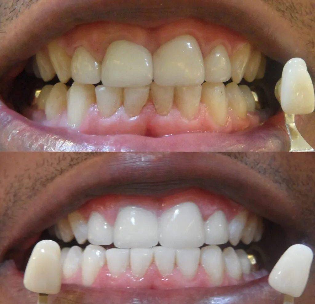 /img/25872-dental-checkup.webp