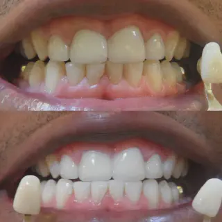 /img/25872-dental-checkup.webp