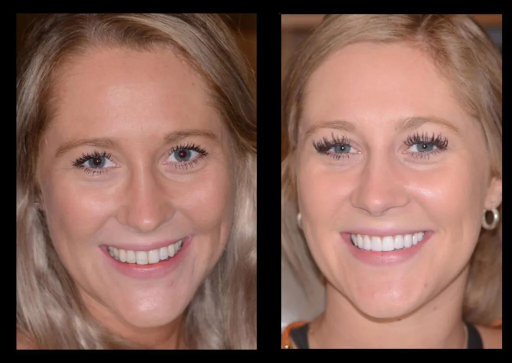 /img/25875-dental-checkups.webp