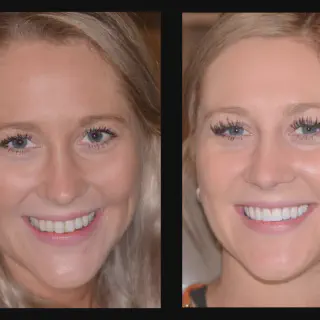 /img/25875-dental-checkups.webp