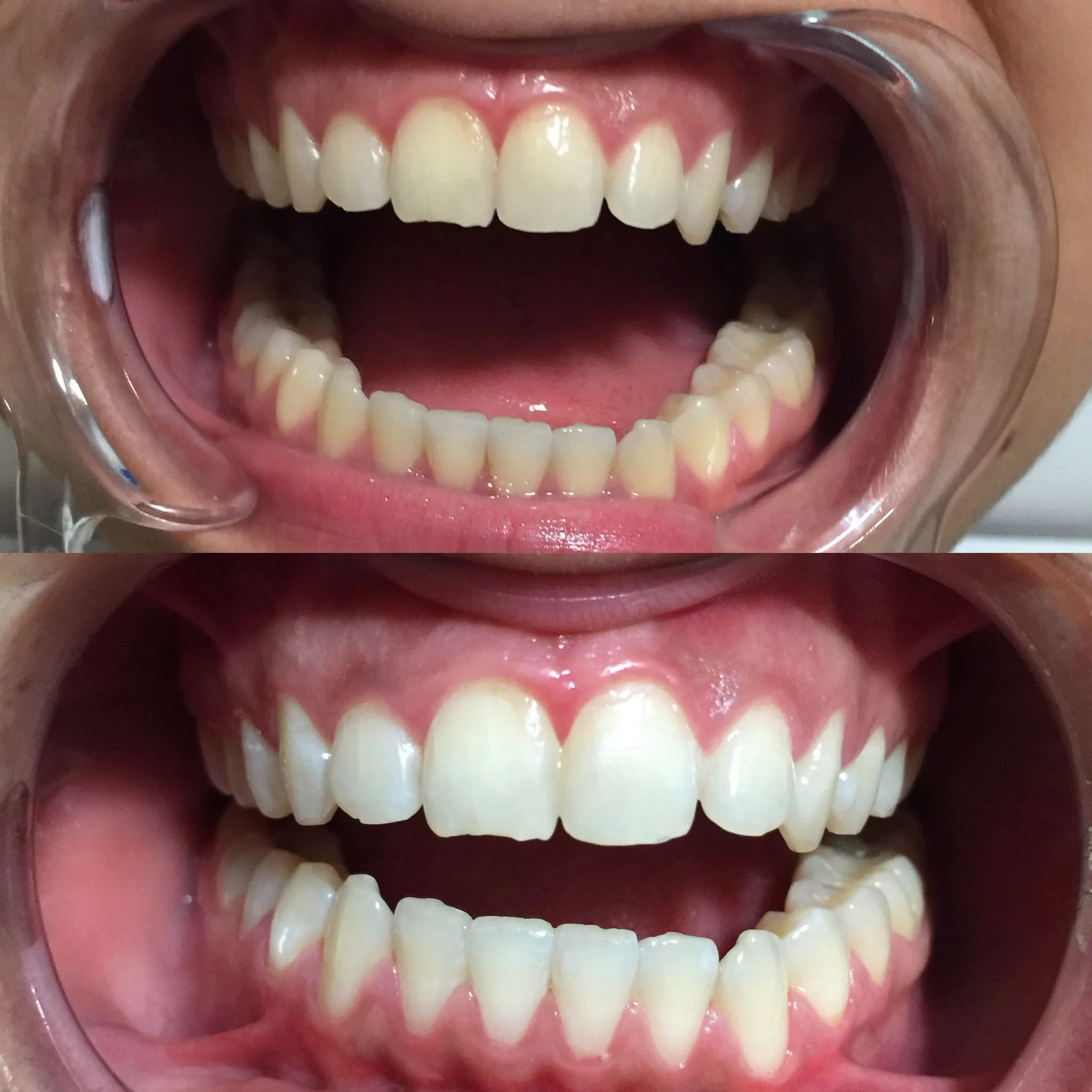 25875 oral hygiene routine